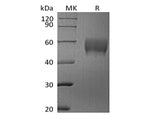 Recombinant Human Siglec-7/CD328 (C-6His)