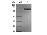 Recombinant Human IL-23 alpha & Mouse IL-12 beta Heterodimer (C-6His) Purity >95%