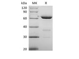 Recombinant Human 5'-Nucleotidase/5'-NT/CD73 (P21589, C-6His)