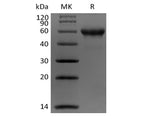 Recombinant Human Carbonic Anhydrase IX/CA9 (C-Avi-6His) Biotinylated