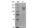 Recombinant Human CEACAM5/CD66e/CEA (C-6His-Avi) Biotinylated