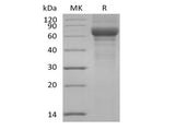 Recombinant Human Vitronectin/VTN (N-Truncated, C-6His)