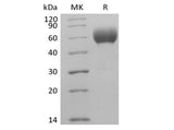 Recombinant Human Signal-Regulatory Protein  alpha-1/SIRPA/CD172a (C-6His-Avi) Biotinylated