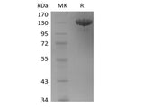 Recombinant Human Tie-2 (C-Fc)