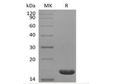 Recombinant Human IL-36 Beta/IL-1F8(153AA)