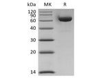 Recombinant Human LAG-3/CD223 (C-6His-Avi) Biotinylated