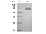 Recombinant Human Serpin A7/TBG (C-6His)