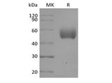 Recombinant Human Signal-Regulatory Protein  alpha-1/SIRPA/CD172a (C-6His)