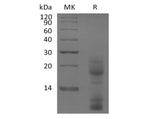 Recombinant Human TSLP (C-10His)