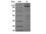 Recombinant Human Glypican-3/GPC3/OCI5 (C-Fc)