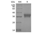 Recombinant Human Stanniocalcin 1/STC-1 (C-6His)