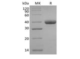 Recombinant Human IgG3 Fc