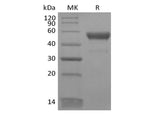 Recombinant Human CD300LB/LMIR5 (C-Fc)