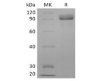 Recombinant Human Receptor Tyrosine-Protein Kinase ErbB-3/HER3 (C-6His)