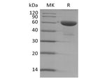 Recombinant Human TMED1 (C-Fc)