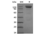 Recombinant Human Siglec-10 (C-mFc)