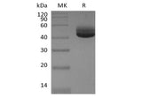 Recombinant Human IL-4 (C-Fc)