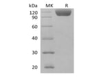 Recombinant Human Siglec-10 (C-Fc)