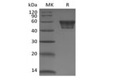 Recombinant Human CD82 (N-Fc)