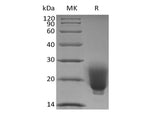 Recombinant Human/Mouse/Rat Irisin/FNDC5 (N-6His) Expression Host HEK293 Cell