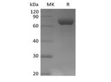 Recombinant Human TPBG/5T4 (C-mFc)
