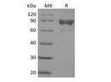 Recombinant Human SIRPB2 (C-Fc)