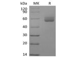 Recombinant Human GAS6 (C-6His)