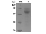 Recombinant Human Tyrosine-protein kinase receptor UFO/AXL oncogene/UFO (C-6His)