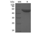 Recombinant Human Siglec-8 (C-6His)