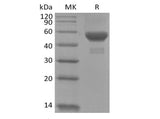 Recombinant Human Carbonic Anhydrase IX/CA9 (C-6His)