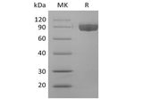 Recombinant Human Afamin/AFM (C-6His)