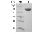 Recombinant Human CD8 Beta Chain/CD8B (C-Fc)