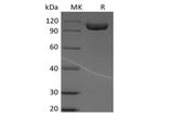 Recombinant Human Immunoglobulin Superfamily Member 8/IGSF8/CD316 (C-Fc)