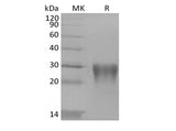 Recombinant Human Transforming Growth Factor Beta-1/TGFB1