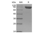 Recombinant Human Siglec-8 (C-Fc)