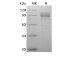 Recombinant Human Otolin-1 (C-6His)