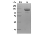 Recombinant Human Receptor Tyrosine-Protein Kinase ErbB-3/HER3 (C-mFc)