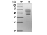 Recombinant Human Interleukin-13/IL-13 (C-mFc)