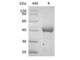 Recombinant Human Activin RIA/ALK-2 (C-Fc)