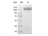  Recombinant Human VEGF Receptor 2/VEGF R2/FLK-1/KDR (C-6His-Avi) Biotinylated