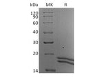 Recombinant Human Interleukin-2/IL-2 (C-6His-Avi) Biotinylated