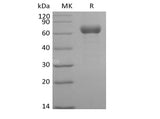 Recombinant Human Angiopoietin-related Protein 3/ANGPTL3 (C-Fc)