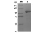 Recombinant Human LRRC32/GARP (C-Fc)