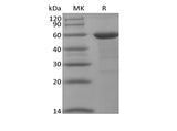 Recombinant Human BRD4 (N-10His-Flag)