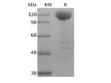 Recombinant Human Siglec-10 (C-Fc-Avi) Biotinylated