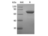 Recombinant Human DC-SIGN/CD209 (N-Fc)