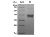 Recombinant Human DC-SIGNR/CD299 (N-8His-Flag)