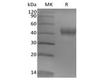 Recombinant Human Tumor-associated Calcium Signal Transducer 2/TROP-2 (248AA, C-6His)