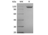 Recombinant Human Tie-2 (C-6His)