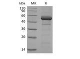 Recombinant Human TACI/TNFRSF13B/CD267 (C-Fc)